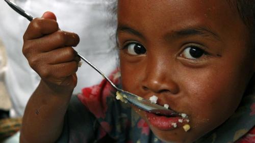 Malnutrition s&eacute;v&egrave;re dans le sud de Madagascar